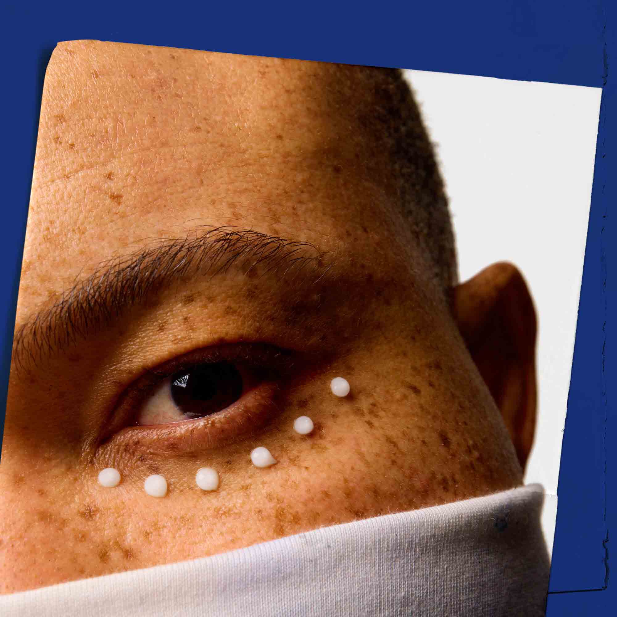 Zbliżenie na skorę wokoł oczu z naniesionym punktowo kremem Facial Fuel Eye Fuel.