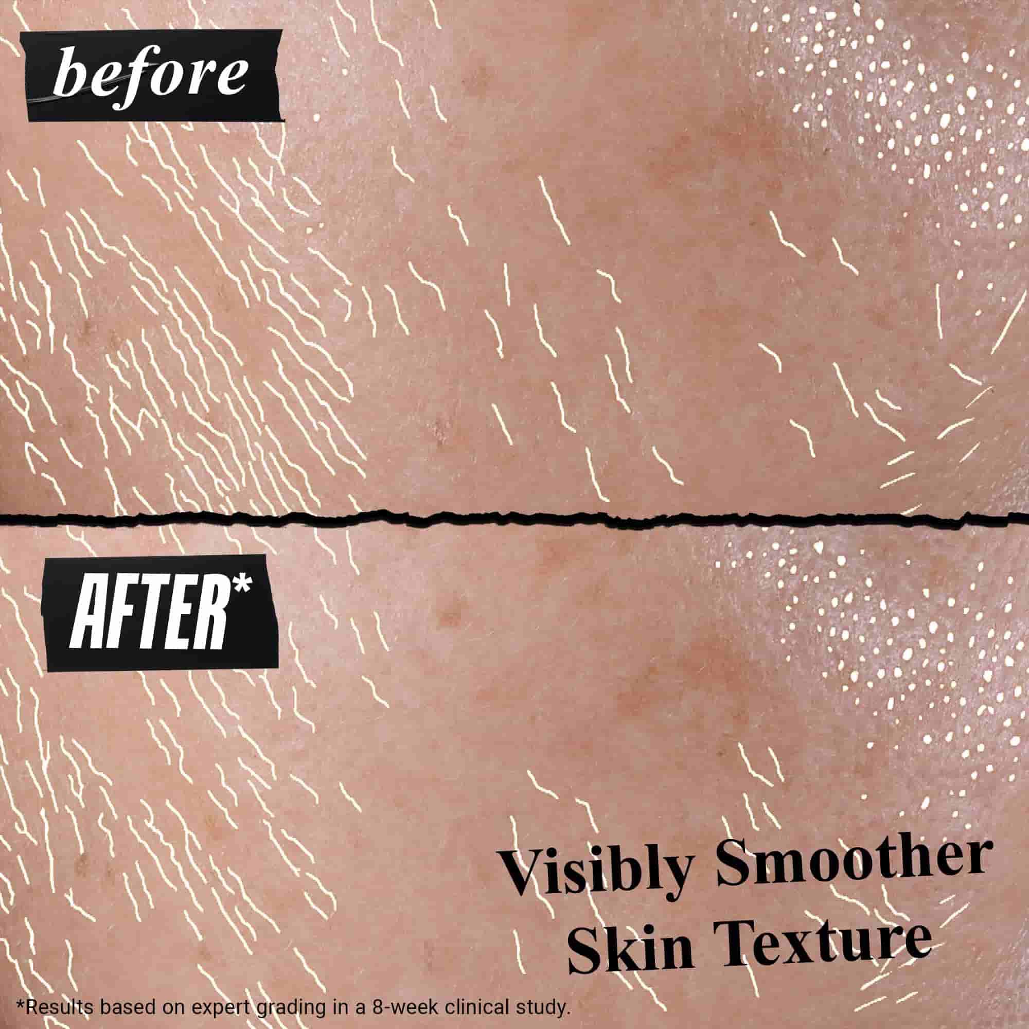 Wyniki przed i po zastosowaniu Better Screen UV Serum na skorze