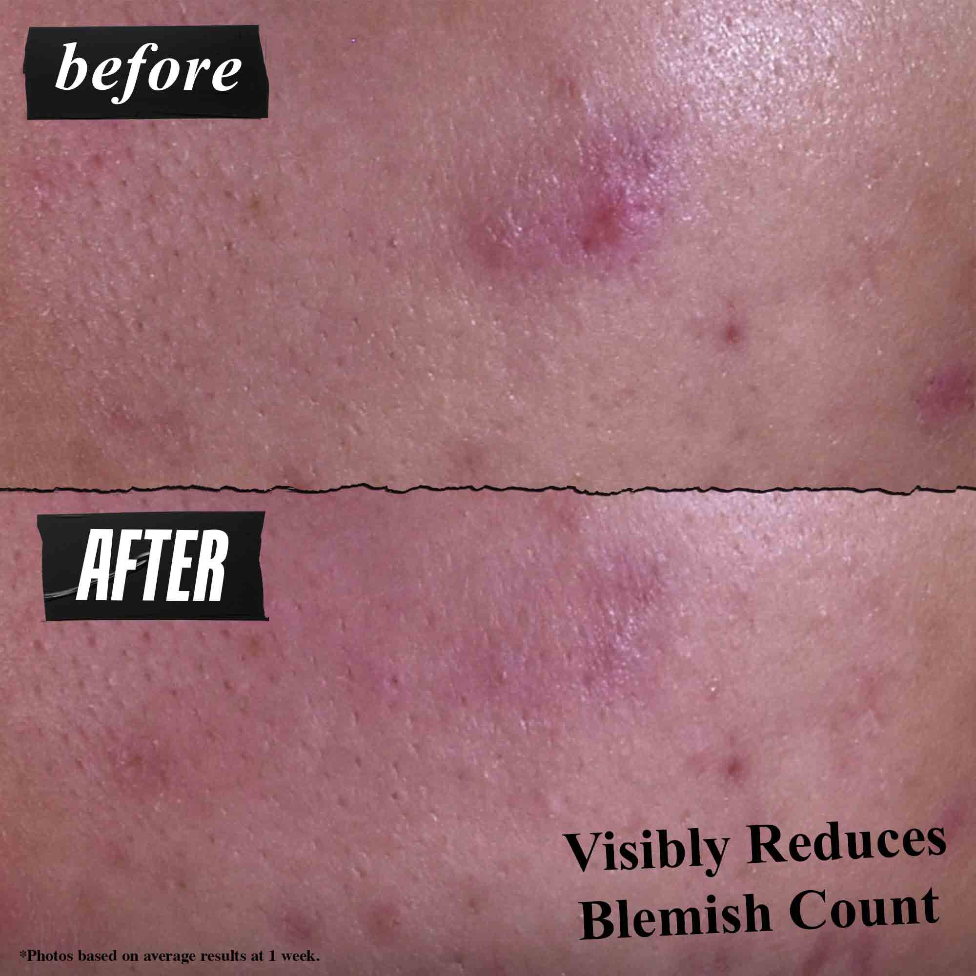 Gently Effective Blemish-Treating Cleansing Paste - Niewysuszająca pasta oczyszczająca z węglem