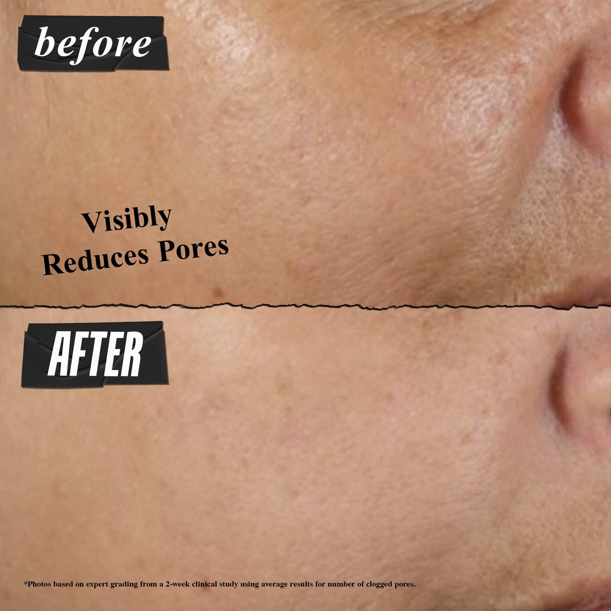 Rare Earth Deep Pore Cleansing Mask - Maseczka głęboko oczyszczająca pory