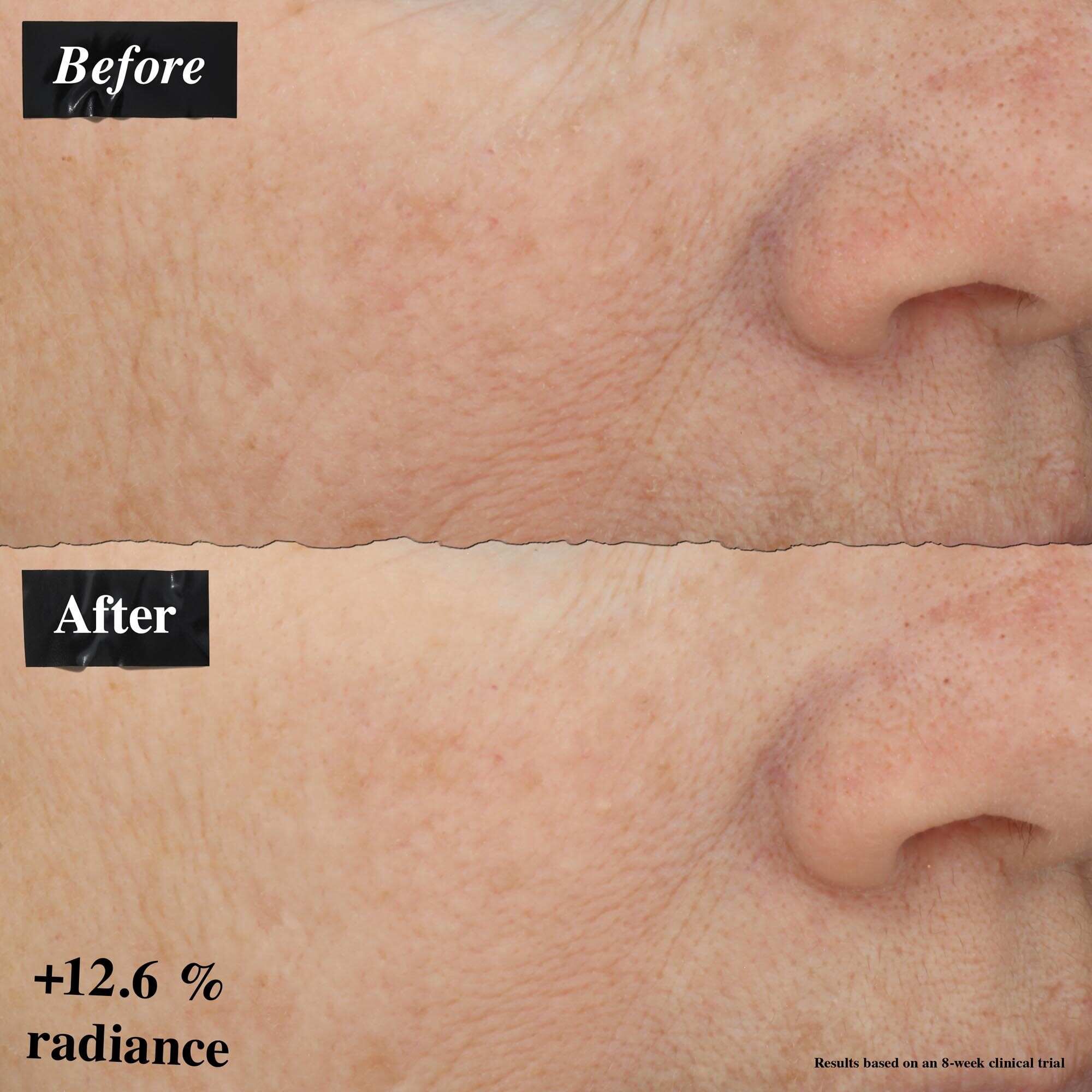 Porownanie zdjęć przed i po pokazujące redukcję zaczerwienienia skory po użyciu Powerful-Strength Line-Reducing Concentrate.