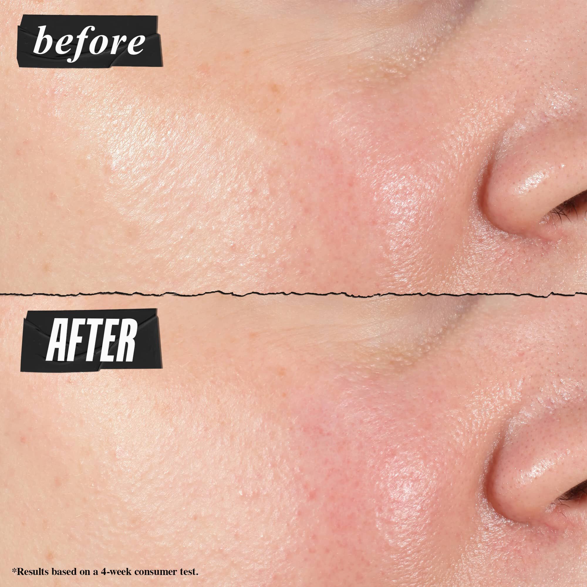 Zdjęcie przed i po – koncentrat serum Kiehl's Hydro Plumping widocznie redukuje pory