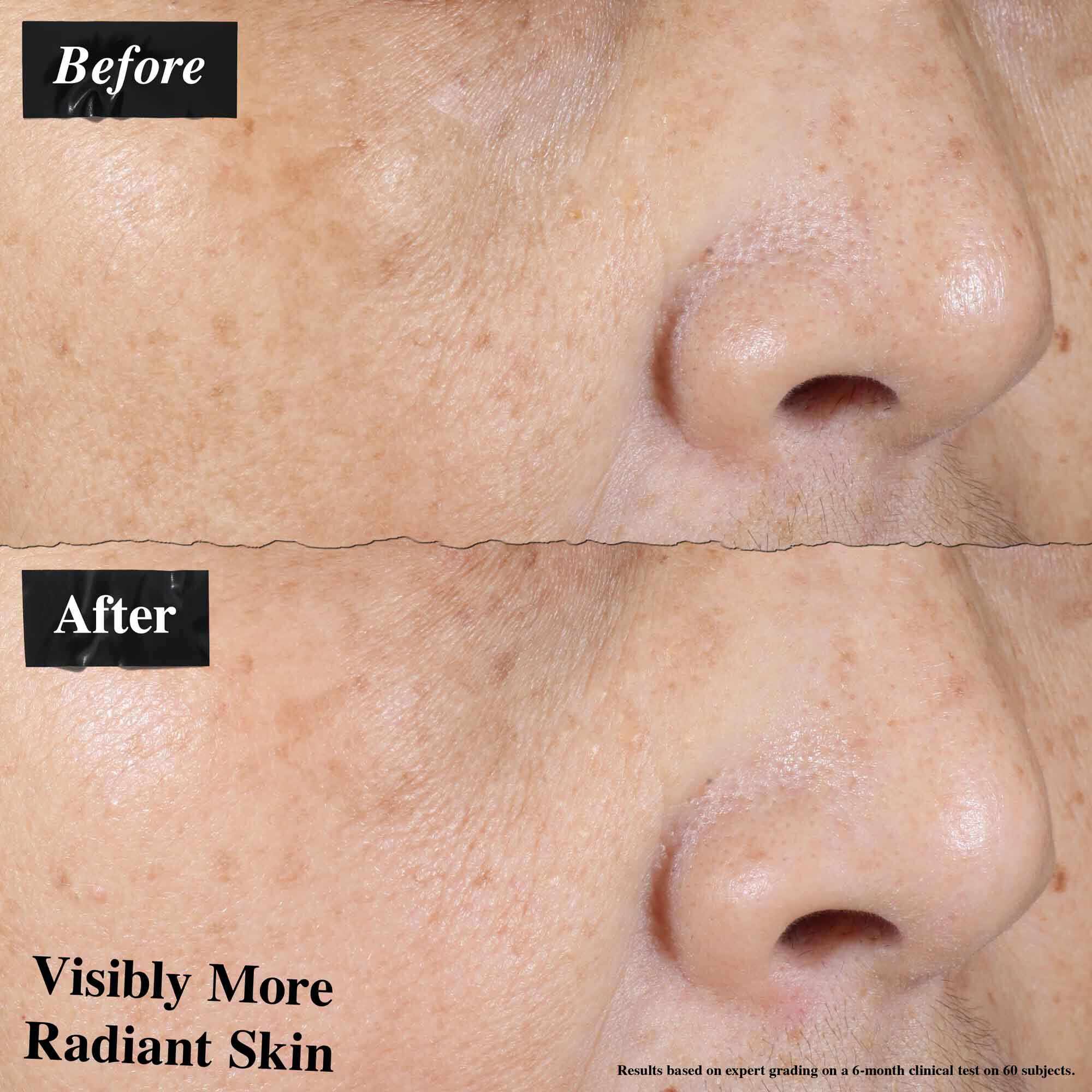 Porownanie przed i po pokazujące widocznie zredukowane zaczerwienienie skory po użyciu Ultra-Light Daily UV Defense.