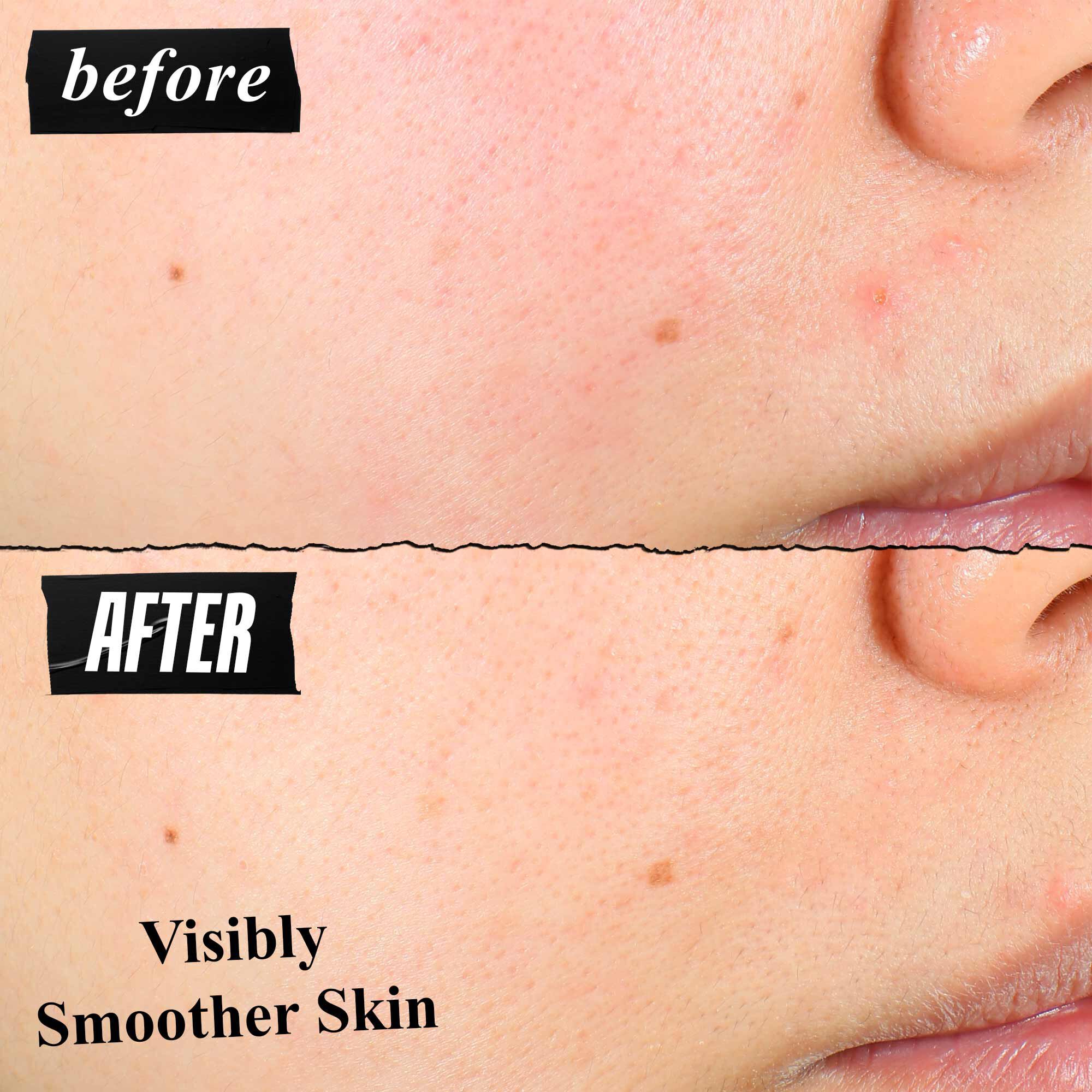 Porownanie tekstury skory przed i po, pokazujące widocznie gładszą skorę po użyciu.