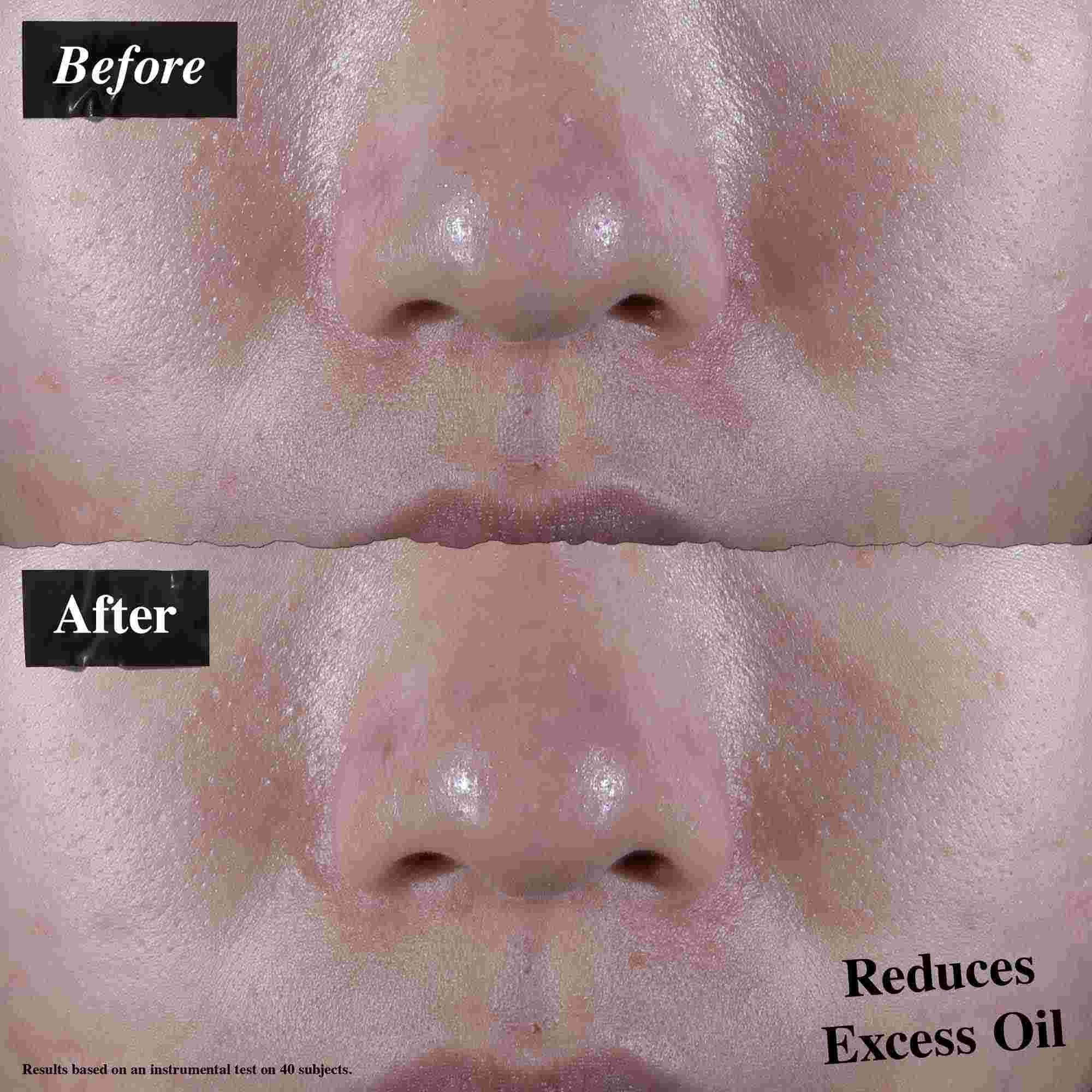 Porownanie przed i po pokazujące redukcję nadmiaru sebum po użyciu żelu-kremu Ultra Facial Oil-Free Gel Cream.