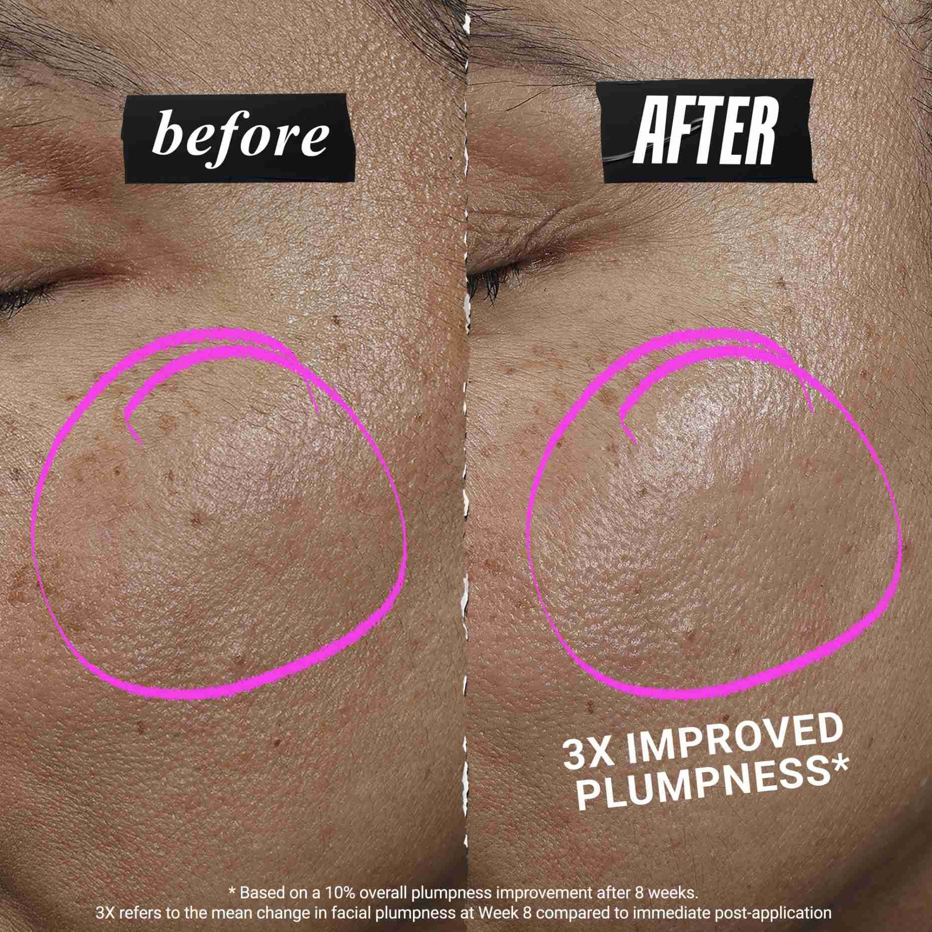 Serum 1cc* CollaShot Plump. Serum nadające efekt wypełnienia