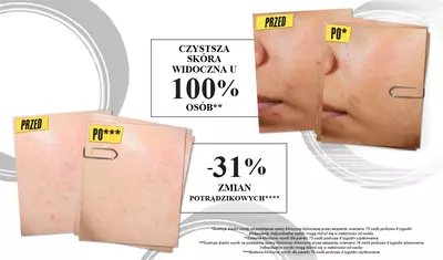Comparison image showing before and after results of acne treatment. The "before" photos display skin with blemishes, while the "after" photos show clearer skin, highlighting 100% of users experienced acne clearing and a 31% reduction in post-blemish marks.