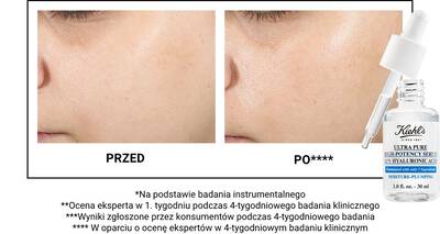 Before and after images showing skin improvement over four weeks, with a dropper bottle of Kiehl's Ultra Pure High-Potency Serum displayed below.